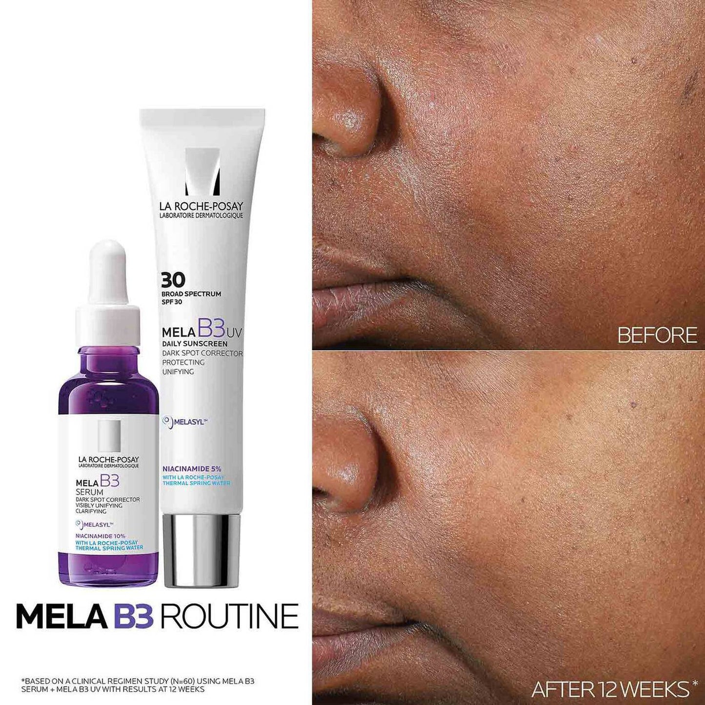 mela-b3-dark-spot-serum-and-mela-b3-uv-daily-moisturizer-with-spf-30-d7 3-Mela-B3-routine_1500X1500.jpg