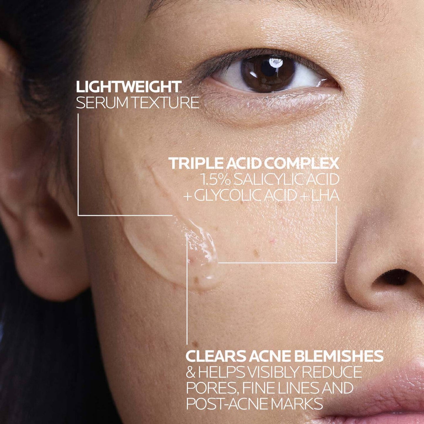 effaclar-salicylic-acid-acne-treatment-serum-e6 LaRochePosay-Product-Effaclar-Effaclar-Serum-30ml-3337875722827-Texture-REV.jpg
