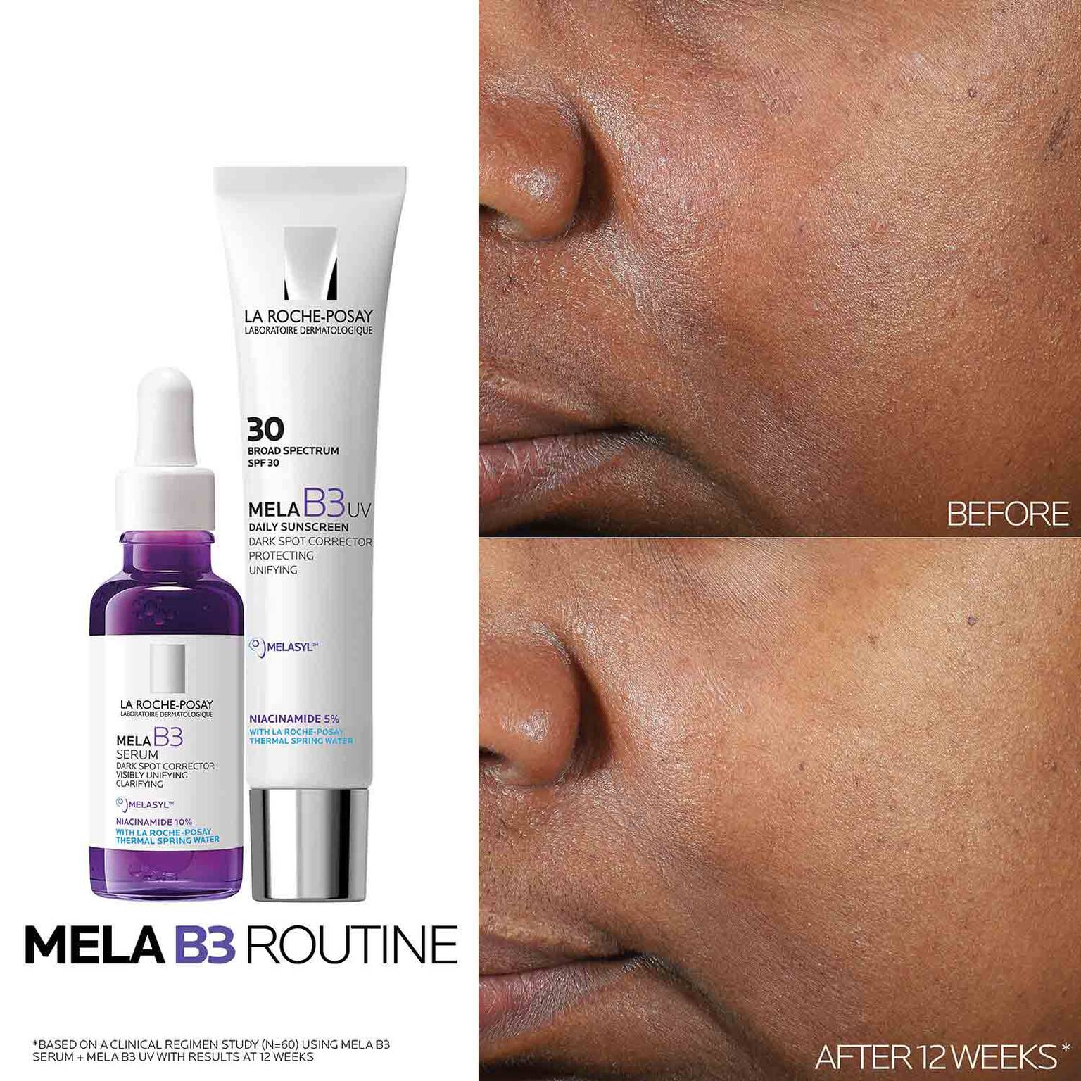 mela-b3-uv-daily-moisturizer-spf-30-with-melasyltm-niacinamide-r6 Mela-B3-routine_1500X1500.jpg